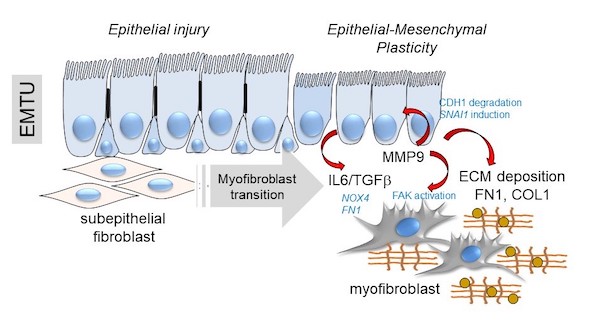 Schematic of the transition of the epithelial-mesenchymal trophic unit (EMTU) of the small airway