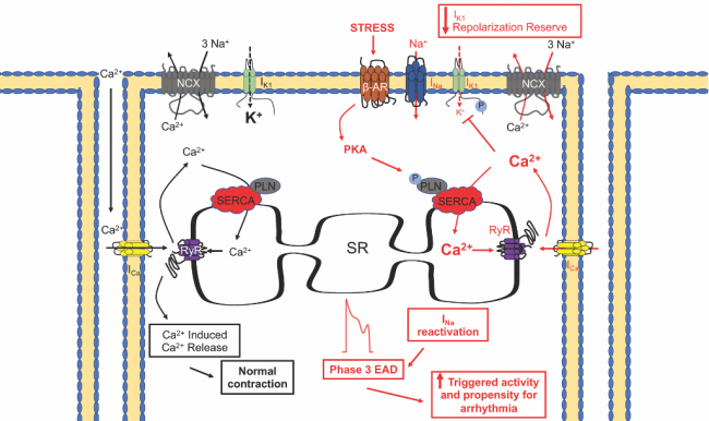 Illustration of how cellular mutations cause an arrhythmia