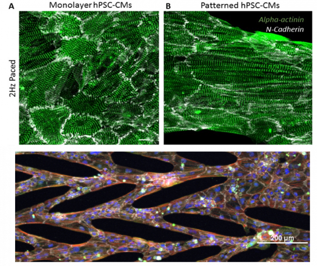 Images of human pluripotent stem cell-derived cardiomyocytes on patterned vs. unpatterned platforms
