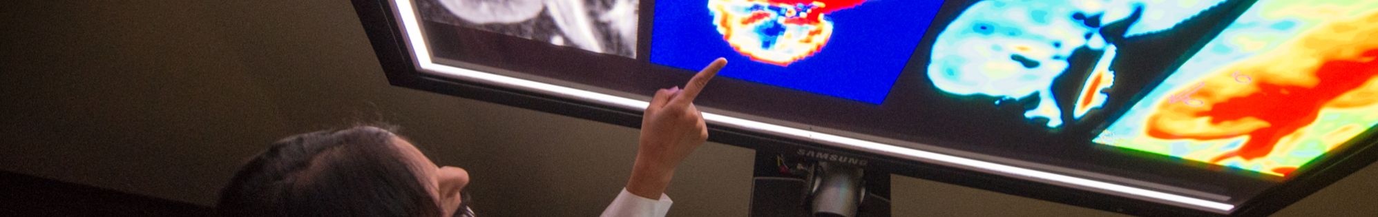 Nephrology faculty member pointing at a digital image of a kidney on a large wall-mounted monitor