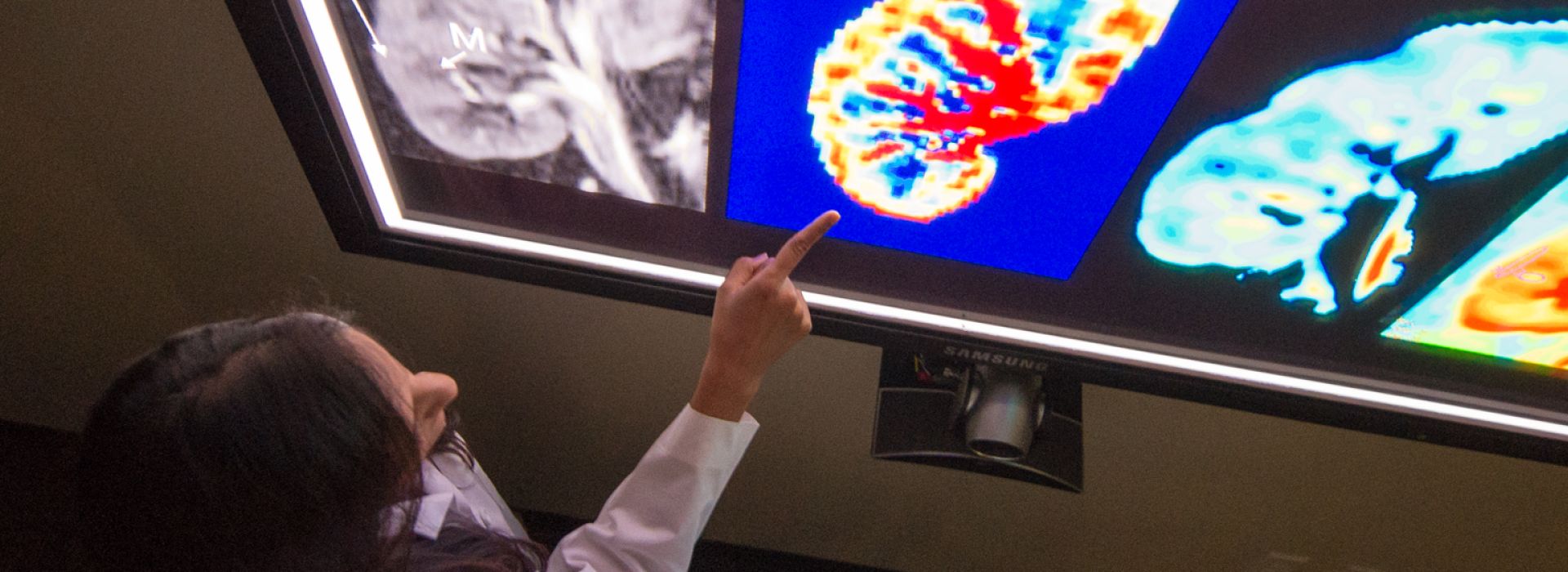 Nephrology faculty member pointing at a digital image of a kidney on a large wall-mounted monitor
