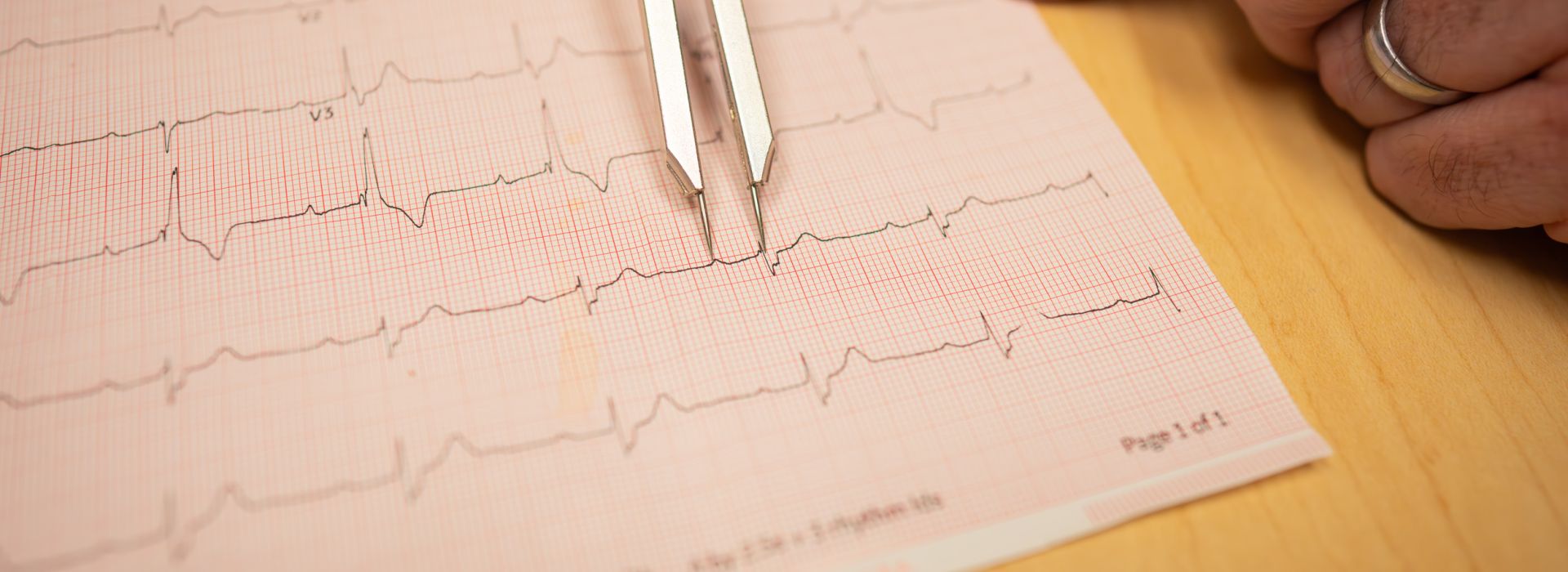 Chart of a sinus rhythm.