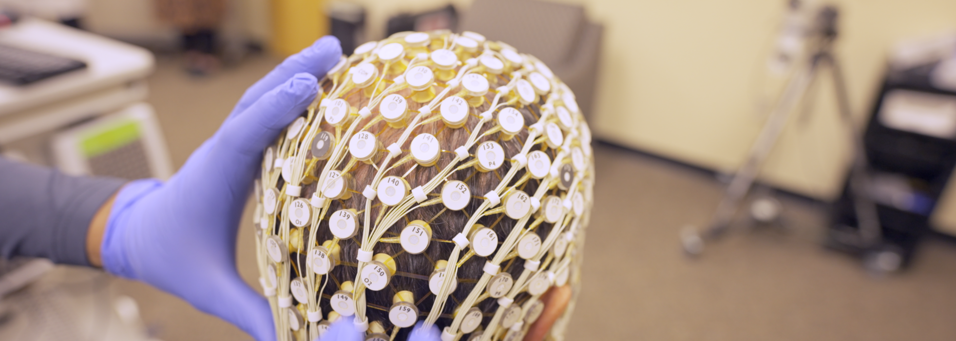 Photo of the back of a person's head with leads attached, in preparation for a sleep study
