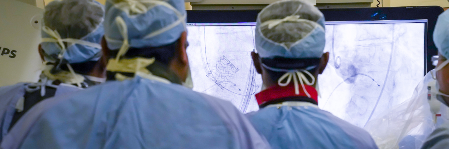 Interventional cardiologists looking at screen int the cath lab