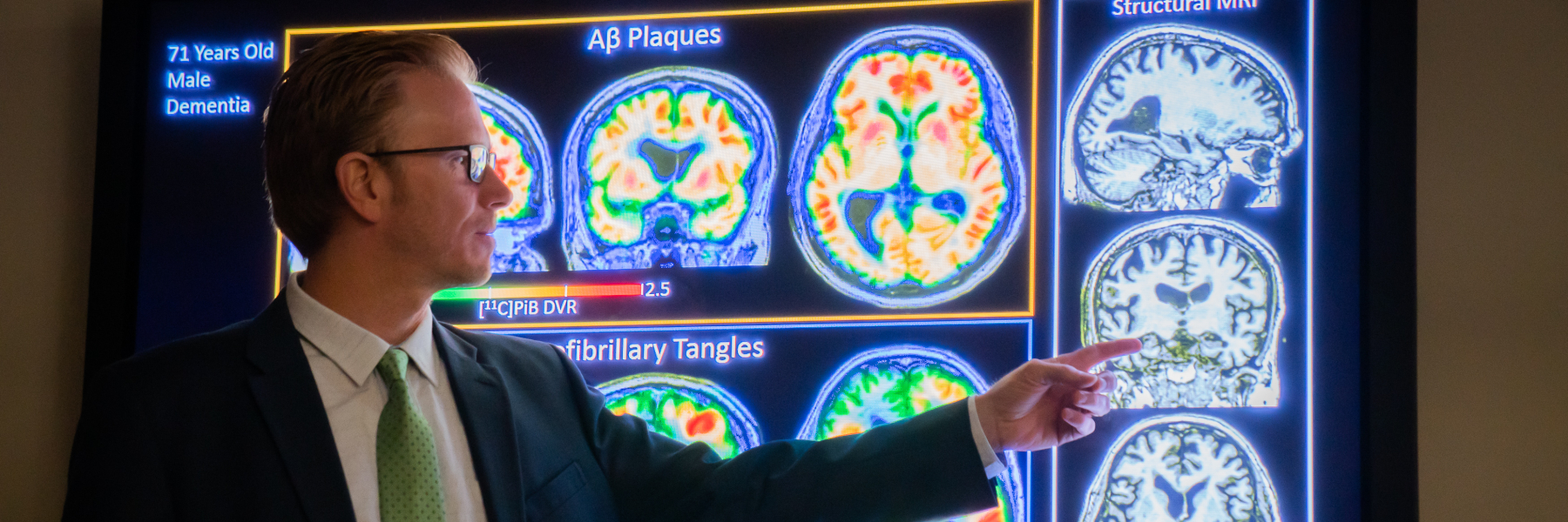 Dr. Sterling Johnson showing images of brain scans