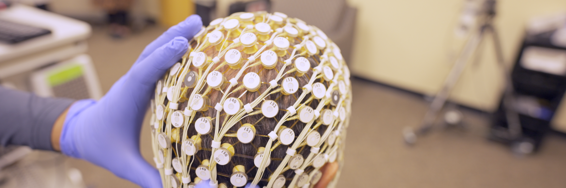photo of person with leads preparing for sleep study