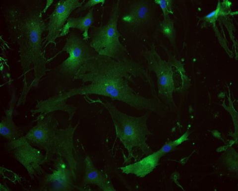 Cultured human lung cells stained for the pericyte marker PDGFRß
