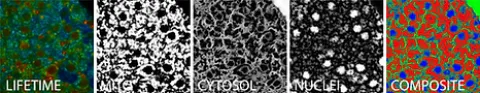 Visualizing pancreatic islet metabolism with 2-photon NAD(P)H fluorescence lifetime imaging