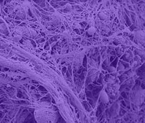 image of biofilm