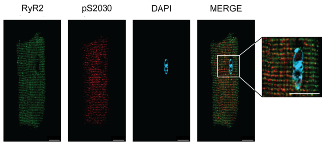 Regulation of cardiac function by sympathetic function