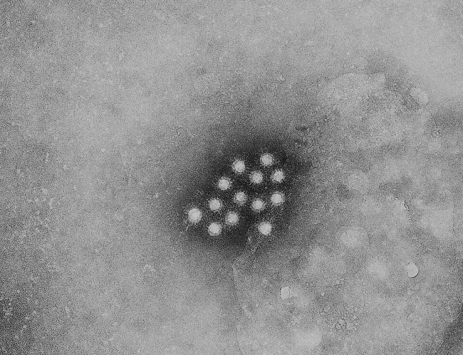Hepatitis A virus particle