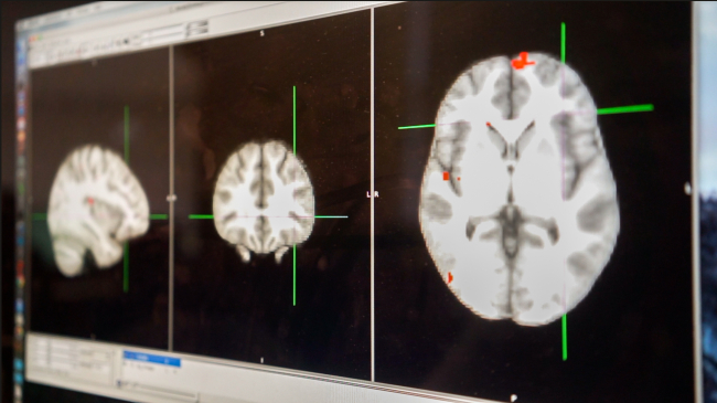 brain scans for asthma neurocircuitry research