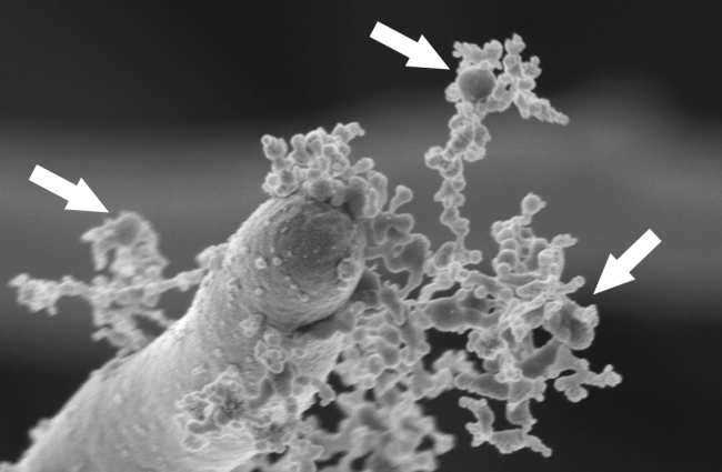 Candida albicans extracellular vesicles