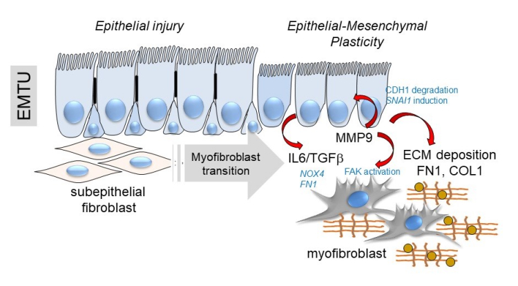 Schematic of the transition of the epithelial-mesenchymal trophic unit (EMTU) of the small airway