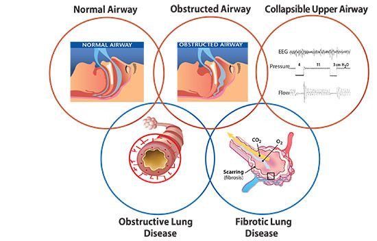 diagram of airway scenarios