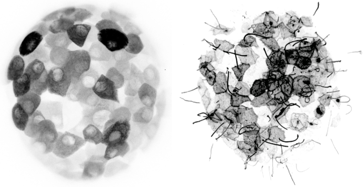 Visualizing pancreatic islet metabolism with 3D imaging of lactate (2-photon, left) and plasma membrane ATP/ADP (spinning disk confocal, right).
