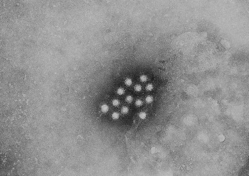 Hepatitis A virus particle