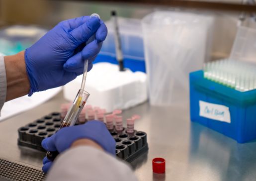 Alzheimer's disease research