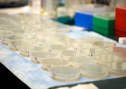 Four of 13 UW-Madison Microbiome Initiative Projects Involve Department of Medicine Members