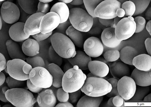 Saccharomyces cerevisiae