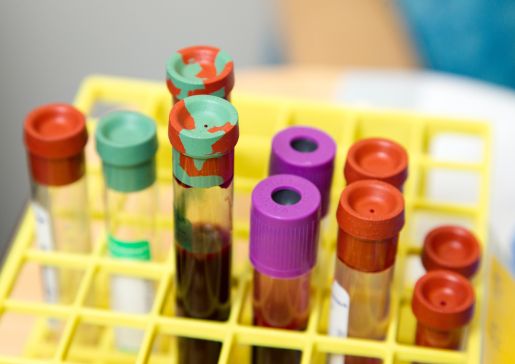 Stock image of blood vials