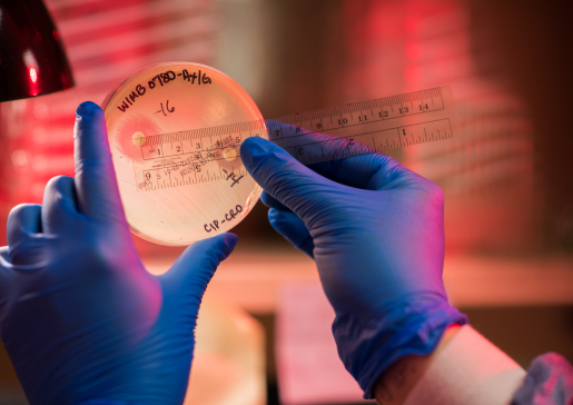 Closeup of researcher's gloved hands measuring a specimen in a petri dish