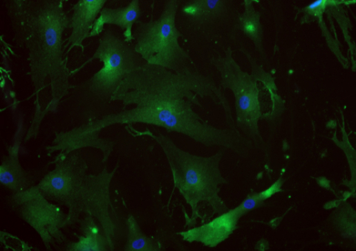 Cells that are positive for the pericyte marker PDGFR-beta (green) are isolated and cultured from donated human lung tissue and used for experiments. Nuclei are stained blue.