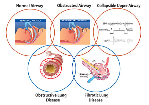 Illustration of airway scenarios