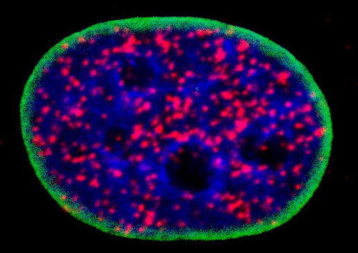 The nucleus of a cell