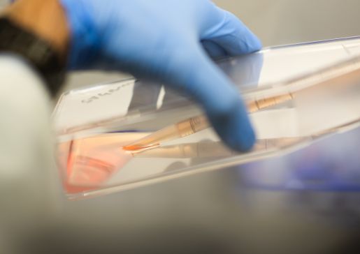 Closeup of researcher's gloved hand removing fluid from a bottle with a dropper